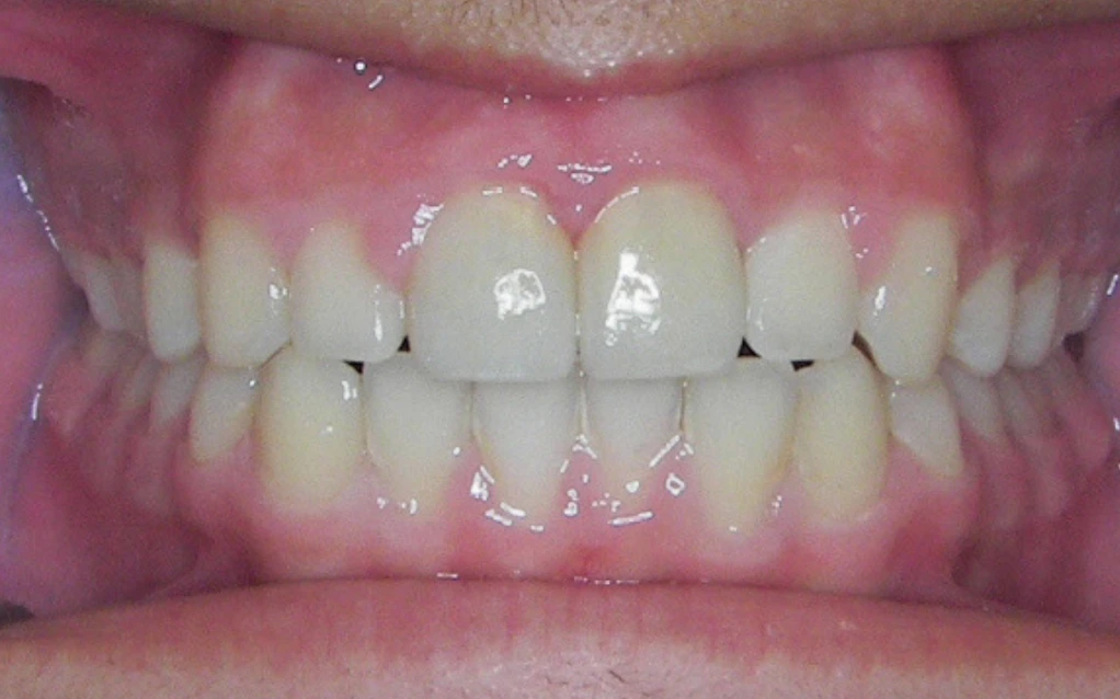 second image